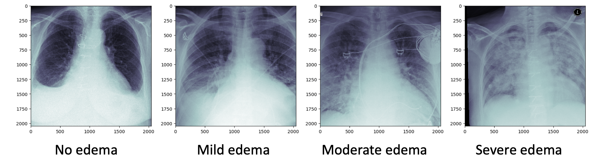 Example x-ray images: